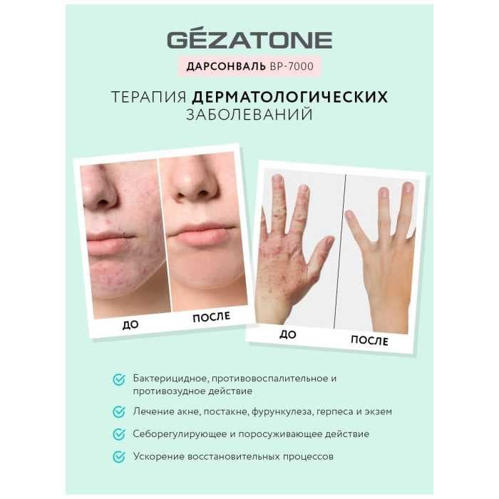 Оборудование для дарсонвальной терапии Gezatone BP-7000 (5 насадок), бирюзовый