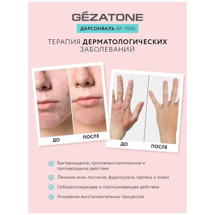 Оборудование для дарсонвальной терапии Gezatone BP-7000 (5 насадок), розовый