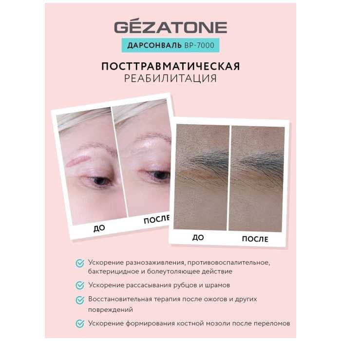 Оборудование для дарсонвальной терапии Gezatone BP-7000 (5 насадок), розовый