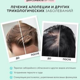 Оборудование для дарсонвальной терапии Gezatone BP-7000 (5 насадок), бирюзовый