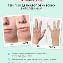 Оборудование для дарсонвальной терапии Gezatone BP-7000 (5 насадок), бирюзовый