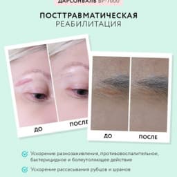 Оборудование для дарсонвальной терапии Gezatone BP-7000 (5 насадок), бирюзовый