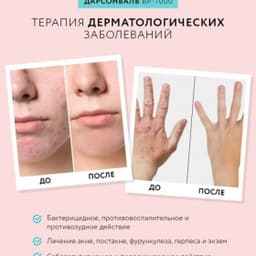 Оборудование для дарсонвальной терапии Gezatone BP-7000 (5 насадок), розовый