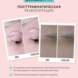 Оборудование для дарсонвальной терапии Gezatone BP-7000 (5 насадок), розовый