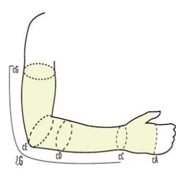 Изделие медицинское компрессионное "ERGOFORMA": рукав (длинный, до пальцев с ремнем и наплечником, с хлопком), 23-32 мм рт.ст. (404)