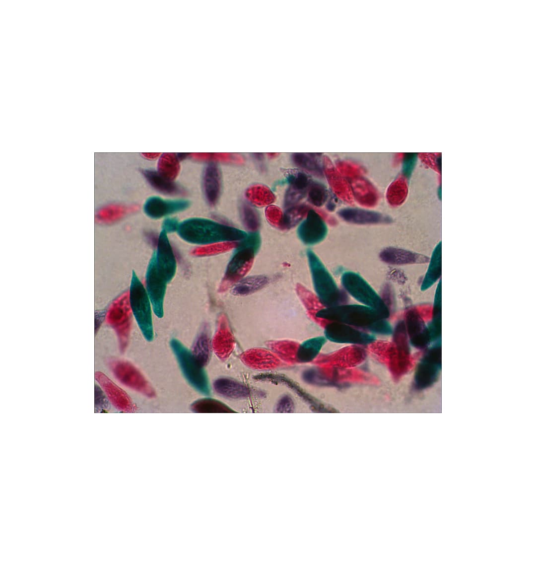 Набор микропрепаратов Levenhuk N18 NG