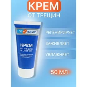 Крем для ног от трещин в ступнях, «До и После», 50 мл