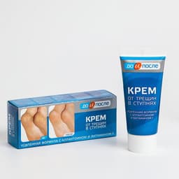 Крем для ног от трещин в ступнях, «До и После», 50 мл