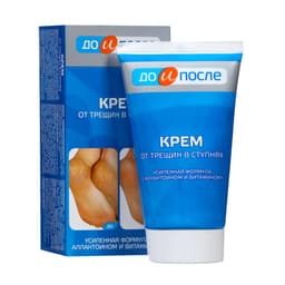 Крем для ног «До и После» от трещин в ступнях, 150 мл