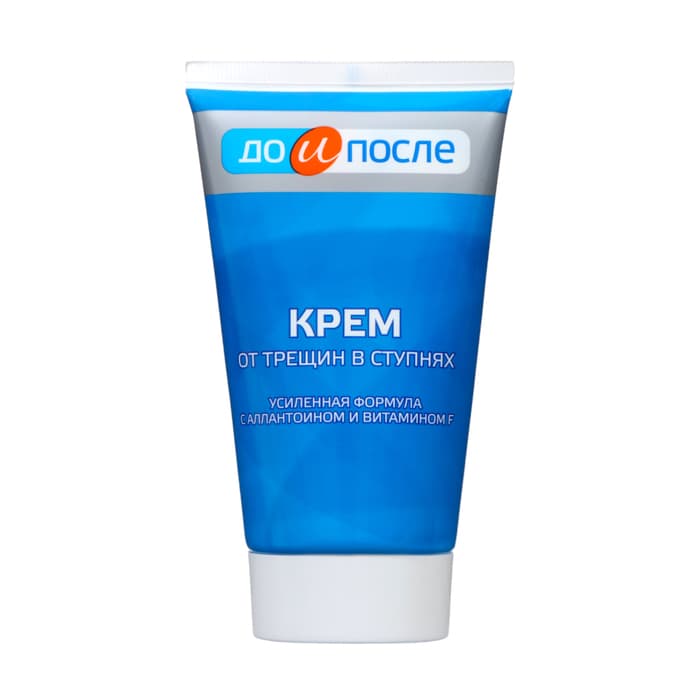 Крем для ног «До и После» от трещин в ступнях, 150 мл