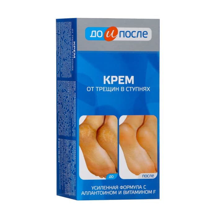 Крем для ног «До и После» от трещин в ступнях, 150 мл