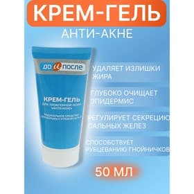 Крем-гель «До и После» Анти-Акне для проблемной кожи, 50 мл