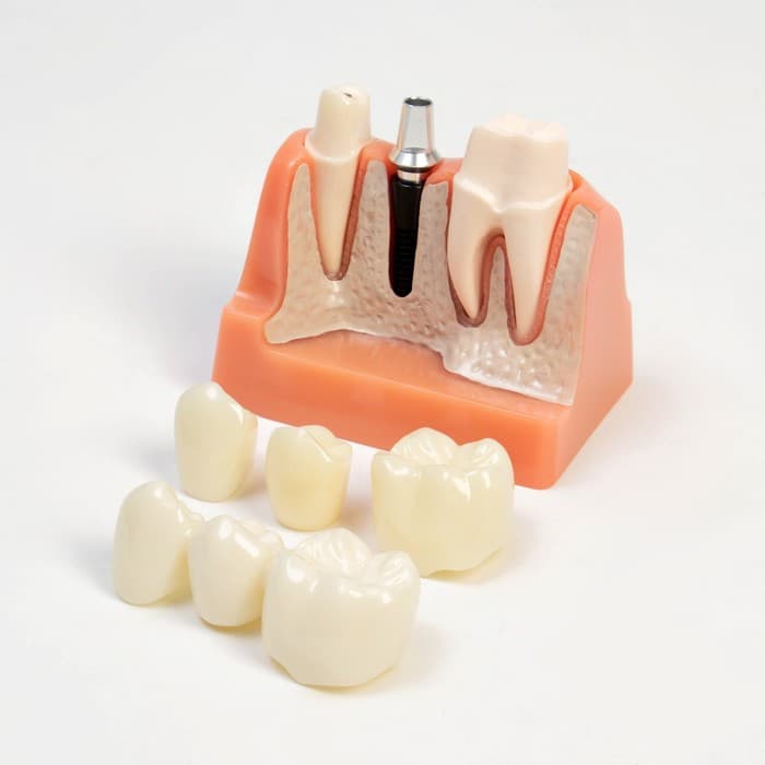 Анатомическая модель «Макет строения зуба», 9×6×9 см