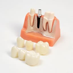 Анатомическая модель «Макет строения зуба», 9×6×9 см