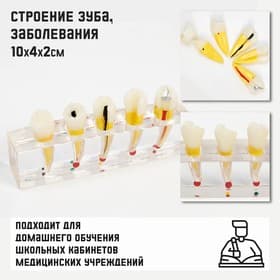 Анатомическая модель «Макет зуба с патологиями», 10×4×2 см