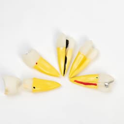 Анатомическая модель «Макет зуба с патологиями», 10×4×2 см