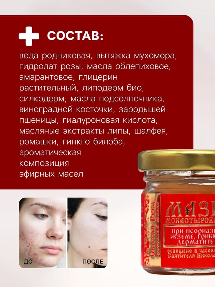 Мазь при псориазе, экземе, грибке, дерматите «Святая Рука», 30 мл