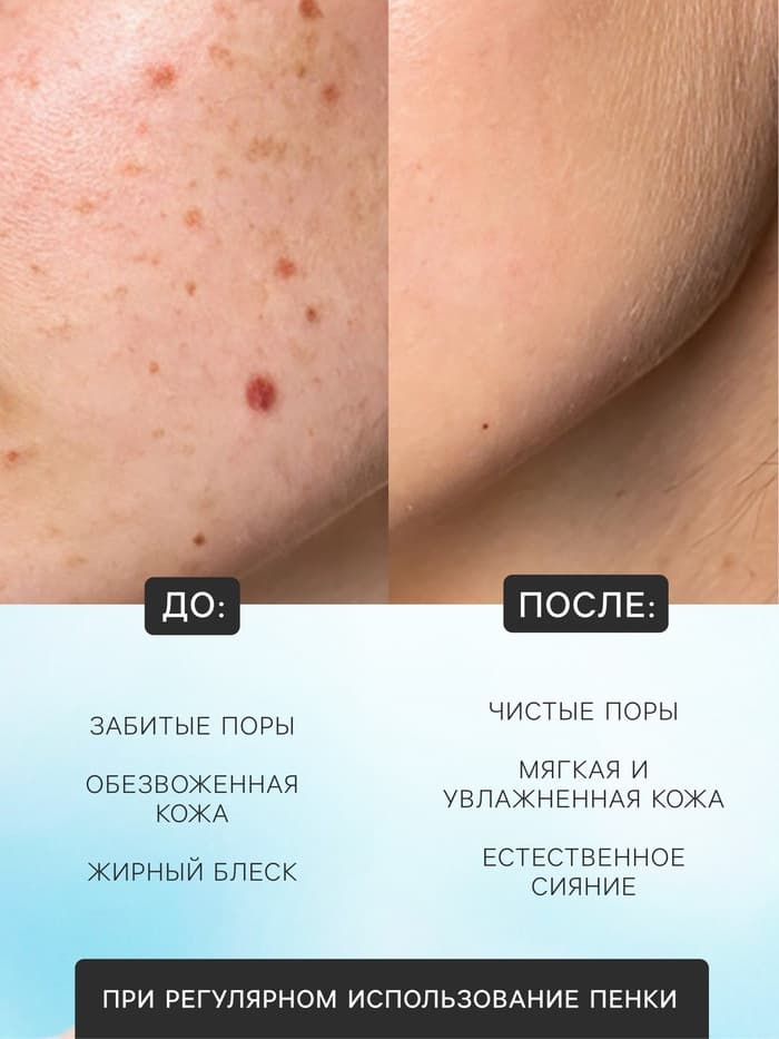 Пенка для умывания с щеткой, для всех типов кожи, с гиалуроновой кислотой, 120 мл