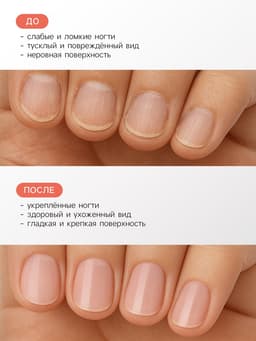 Лак-уход лечебная серия JEANMISHEL 8 в 1 мультикомплекс, 6 мл