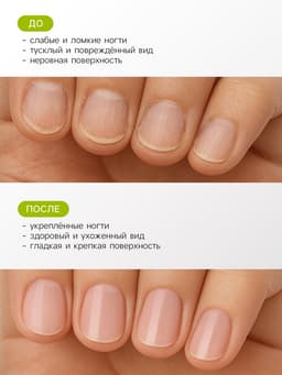 Лак-средство лечебная серия JEANMISHEL восстановление ногтей, 6 мл