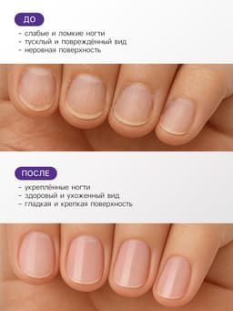 Лак-средство лечебная серия JEANMISHEL антигрибок, 6 мл