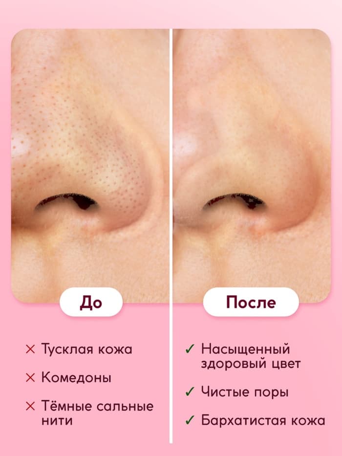 Пилинг-скатка для лица SEMILY с фруктовыми кислотами, мягкое отшелушивание, 75 мл